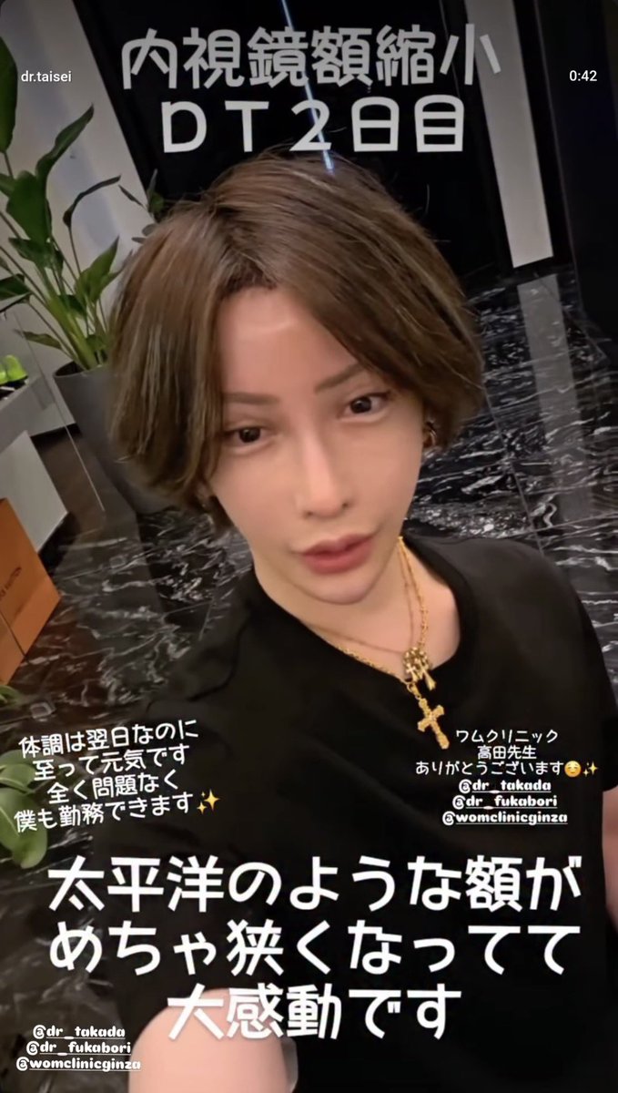 『顎下ペラペラ脂肪吸引』小顔整形専門Dr 深堀 tweet media