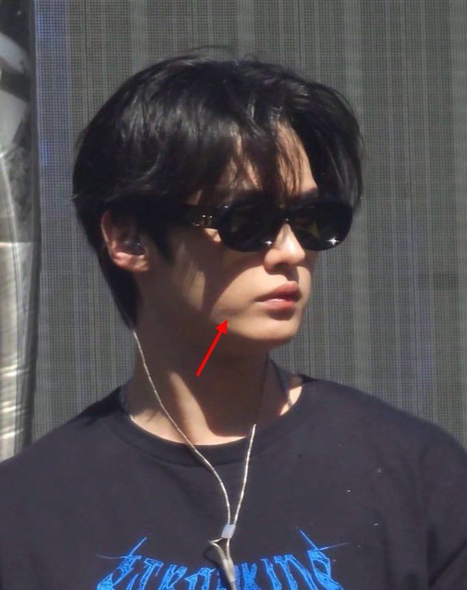 fox ●ᴥ● tweet media