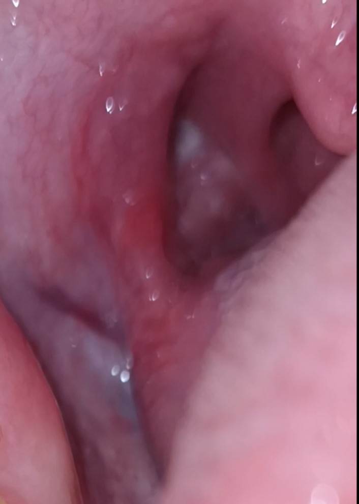 Lawliet xxs tweet media