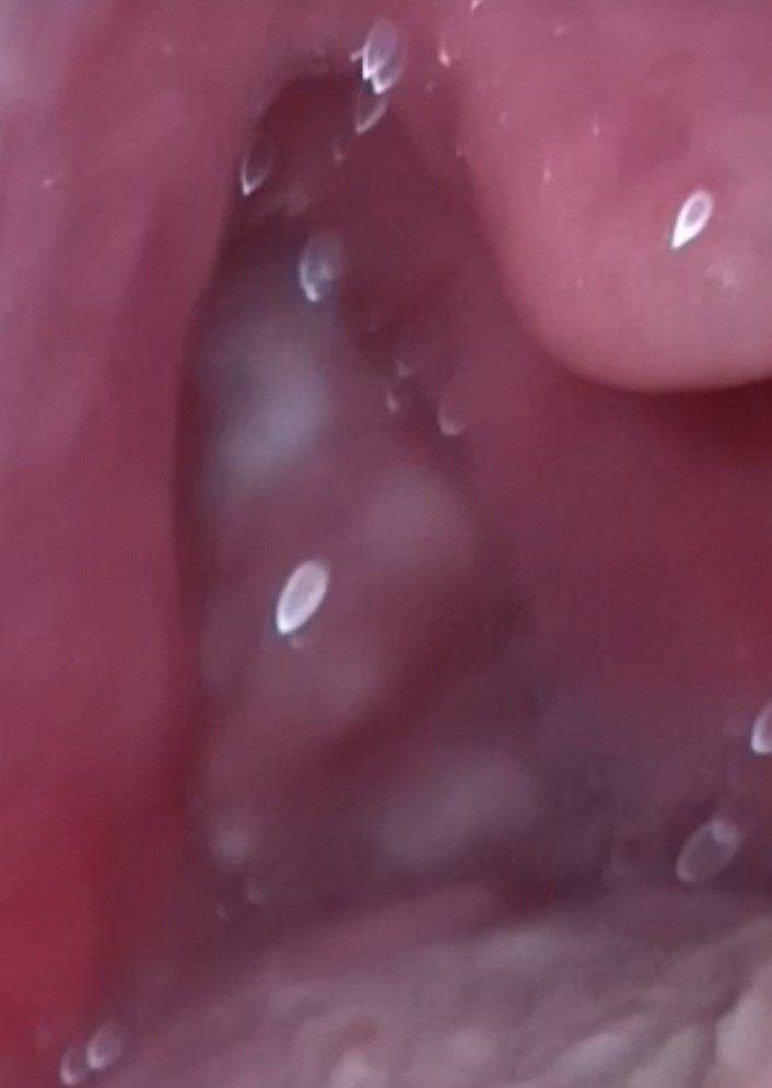 Lawliet xxs tweet media