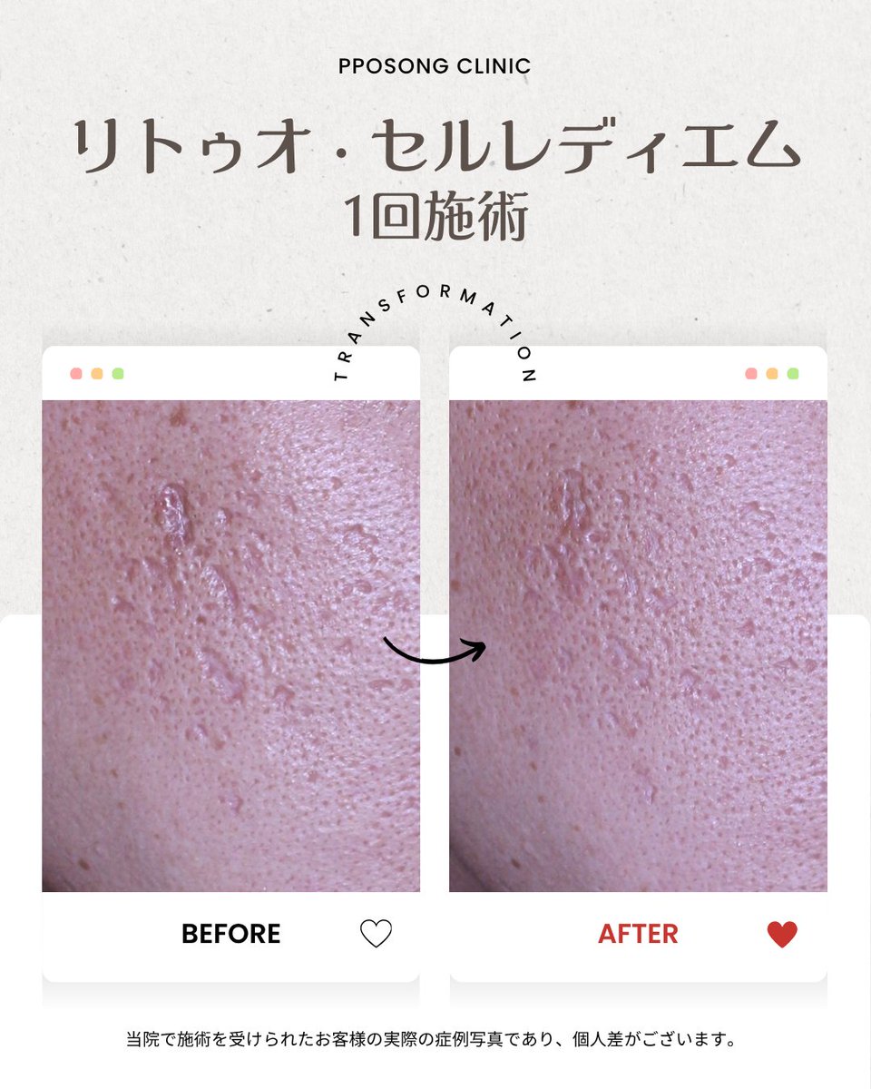 PPOSONG CLINIC tweet media