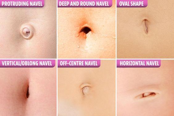 Sin_City007's tweet image. 👀 Did you know your navel shape is different for everyone?

From protruding to deep, oval to horizontal - no two are exactly the same ✨

It’s just another reminder that our bodies are unique in their own way 💫

💬 Which one looks closest to yours?

#DidYouKnow #HumanBody