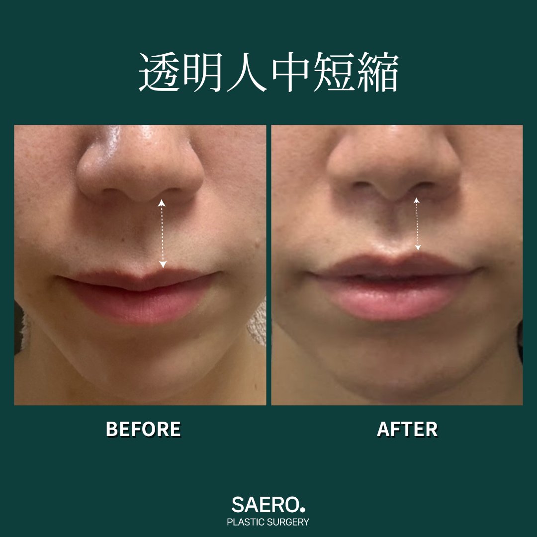 セロ美容外科 tweet media