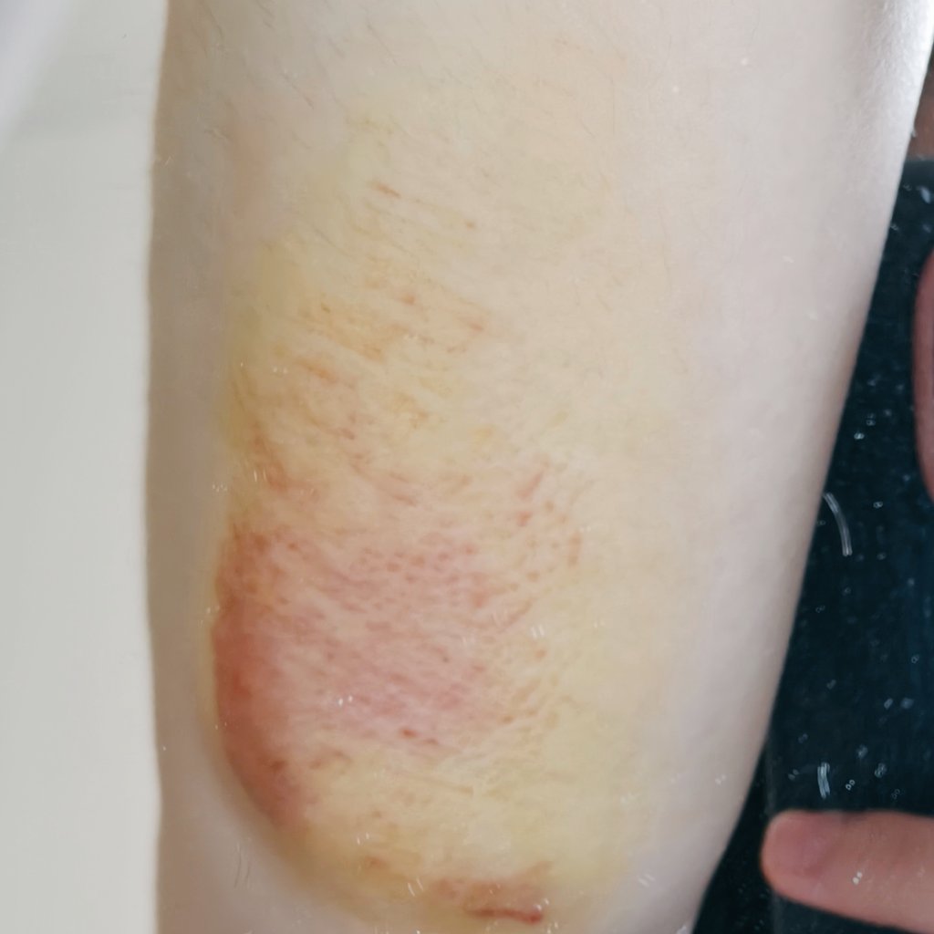 水果糖🪦 tweet media