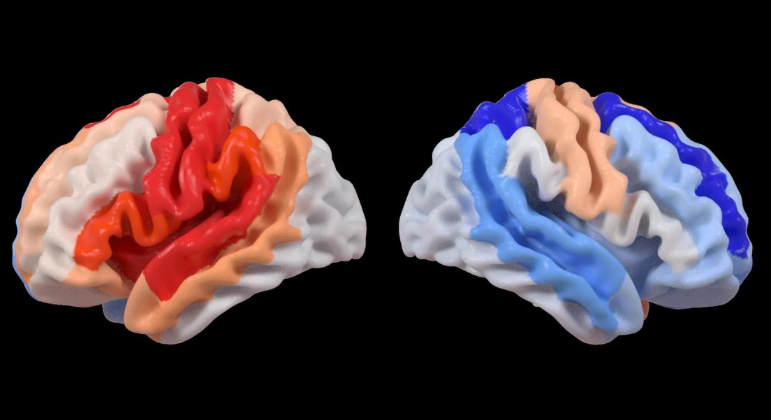 talius's tweet image. #Stroke triggers a hidden #brain #change that looks like #rejuvenation 

AI shows that after a stroke, healthy brain regions can "rejuvenate" to compensate for damage. This youthful rewiring helps the brain adapt when motor systems are impaired. scitechupdates.com/stroke-trigger…
