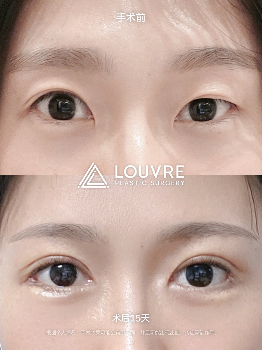 ルーヴル美容外科 tweet media