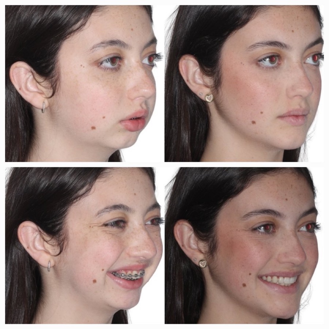 Felipe Leme tweet media