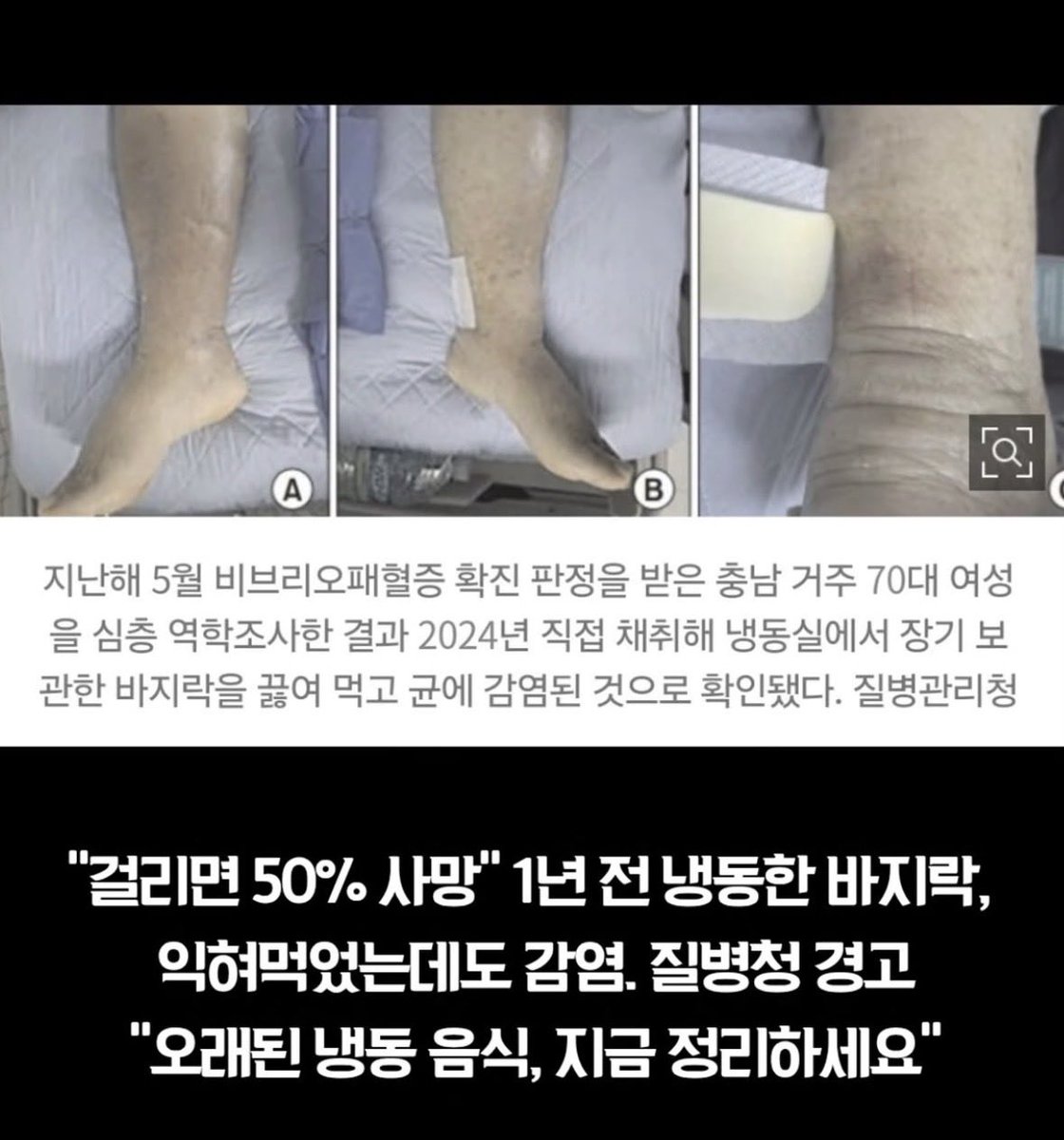 얘드라
냉동음식 조심해
1년된 바지락 해동해 먹었는데 익혀먹엇는데도 비브리오패혈증 걸렸대 
비브리오패혈증은 사망률 50% 이상임