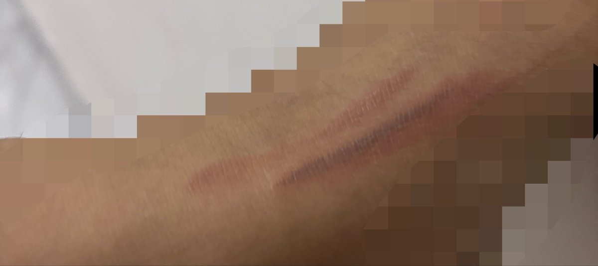 Justinniee's tweet photo. Malah kesetrika kaki😫 https://t.co/AHFfKTU5yV