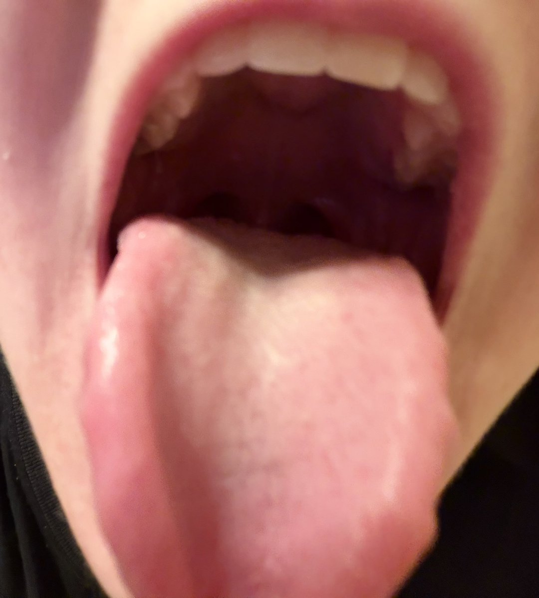 Royal Rabbit 🐰🩵 tweet media