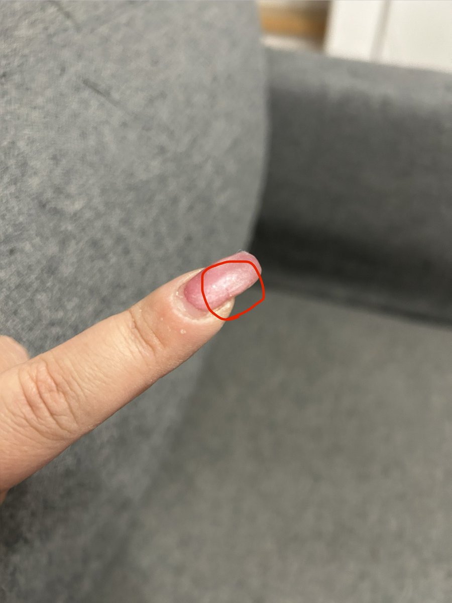 🤮A.(あめゆき)🐏🧡 tweet media