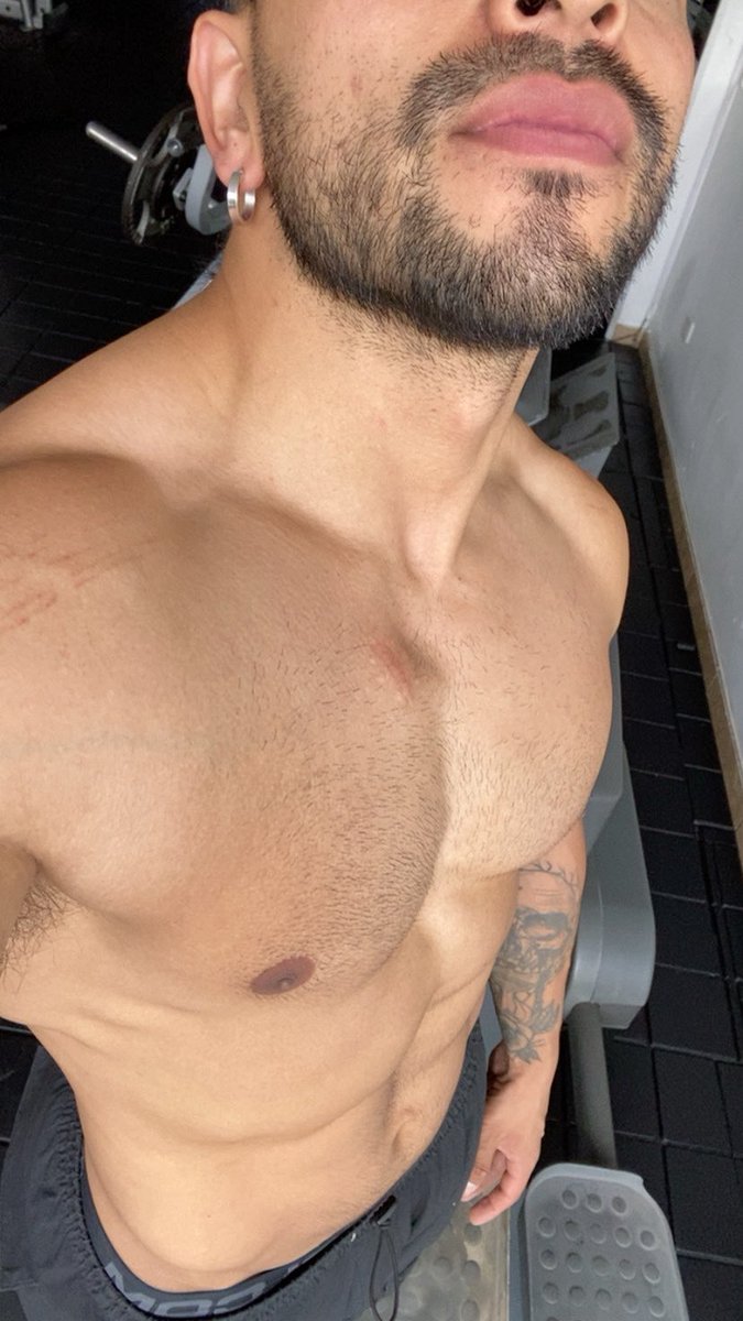 FABIÁN SANABRIA tweet media