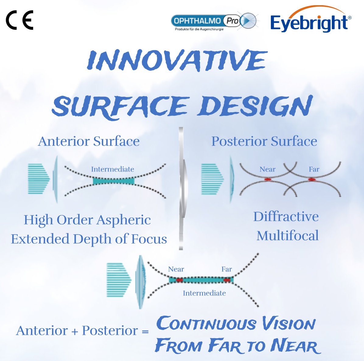 Eyebright2010's tweet photo. Experience quality vision at every distance with the Prosert®preloaded multifocal and extended depth of focus intraocular lens system. With an innovative, unique surface design, the lens delivers continuous far, intermediate, and near vision while reducing visual disturbances. https://t.co/mHpNBLbxvN