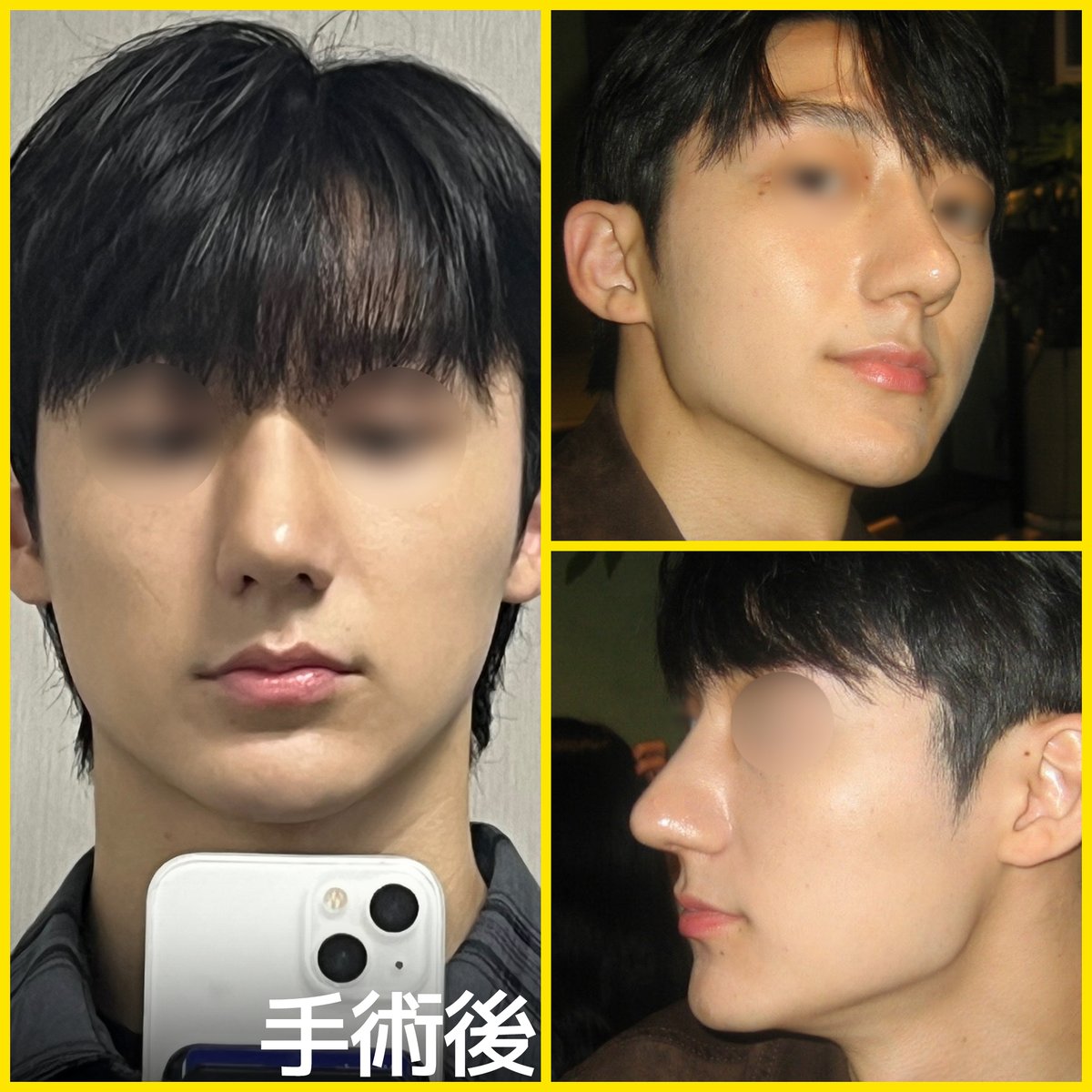 バナナ美容整形外科🍌 tweet media