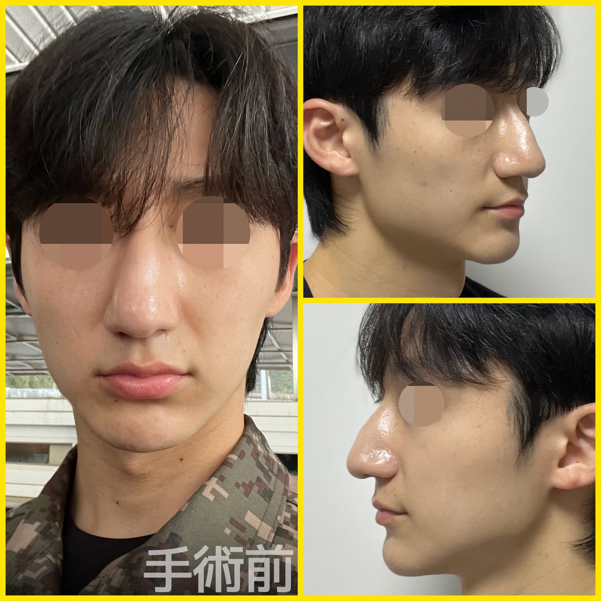 バナナ美容整形外科🍌 tweet media