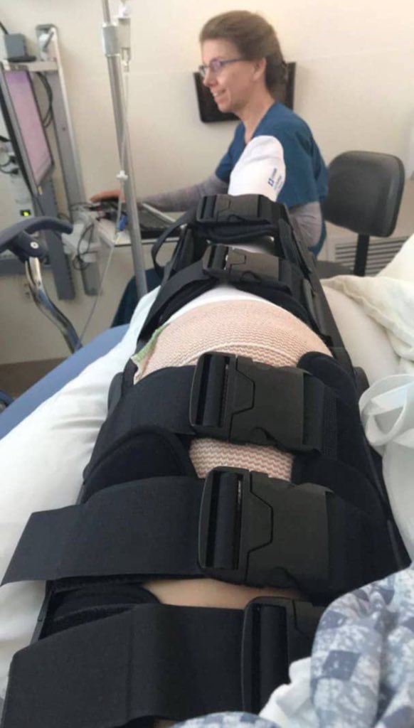 exknighttx's tweet photo. Broken leg proof https://t.co/c5ME2qTgKN