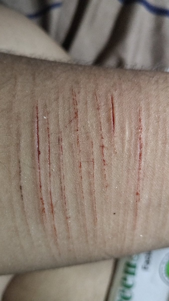 Huohuo of SHTWT ♡ tweet media