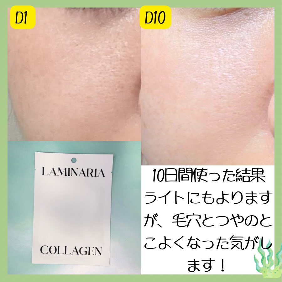 sobakasu_suzu's tweet photo. 真昆布マスク、10日間続けた🌿
劇的な変化より、肌の"ベース"が安定

香りが控えめで刺激もなく
あの昆布っぽいとろとろエッセンス、
かなり面白い
敏感肌でも使いやすいタイプなのでリピ○
詳細レビュー↓
#PR #真昆布パック #真昆布パック10日チャレンジ #真昆布 #ShionLe　#スキンケア @shionle_jp https://t.co/hBmrZYCxIx