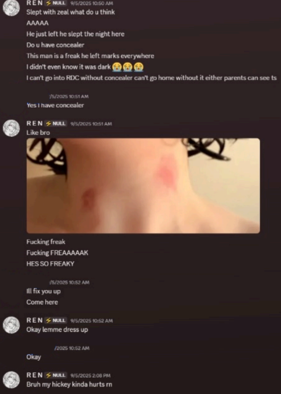 oersaccount's tweet photo. @CanMakiStepOnMe @NYX_J1NX here's another thing about the marks. ren herself calls them hickeys. notice ren's framing, in the dms they are hickeys, in the doc they are marks that have a bruised appearance https://t.co/sF0Vjoopmo