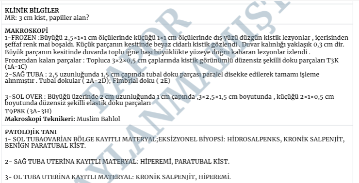 erdinilter's tweet photo. 👠57y kadın hasta, yumurtalıkta papiller çıkıntıları olan kistik kitle görünce ilk aklımıza gelen olası tanı tabii ki de #YumurtalıkKanseri , 
Ancak bu hastamızda da olduğu gibi geçirilmiş enfeksiyonlara bağlı yumurtalık ve tüplerdeki olası değişiklikler de benzer görüntülere neden olabilir.