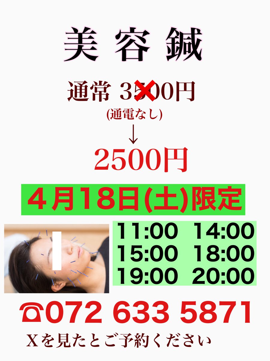 sojiji_maeda's tweet photo. 明日4/18(土)限定！
美容鍼を1000円OFF
お得なこの機会に、ぜひご予約お待ちしております✨
☎︎072 633 5871
#美容鍼 #美容鍼灸 #リフトアップ #ほうれい線 #マリオネットライン #くすみ #たるみ #整骨院 #総持寺 #茨木 #阪急京都線 #JR京都線 https://t.co/BQDY4uSK6y