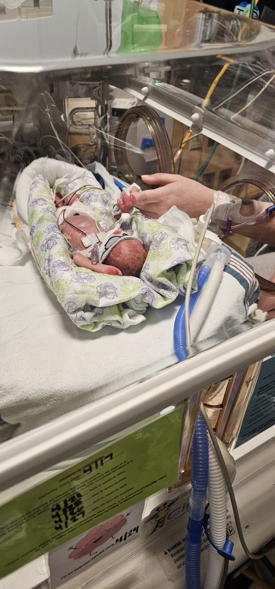 Racerinsider's tweet image. Happy #2 to my grandson Haydan!!! Born prematurely 1.4 lbs you sure have come a long way ! I ❤️ u a bunch ! 🏌️‍♂️⛳️🏆 #Winner #ThinkBig #GoRacers