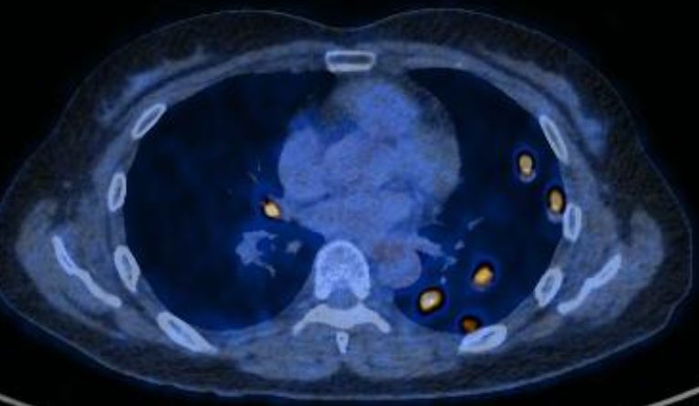 Yannick Buccella MD tweet media