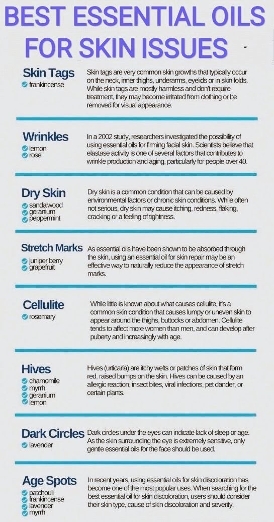 opt_solutions_'s tweet image. Best essential oils for skin issues. Here are the best oils for cancers: youtu.be/eh9gi99dfVE?si… 💜
#skin #essentialoil