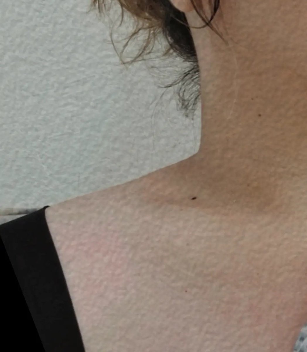 อีงูพิษ 🐍🐍🐍🐍 tweet media