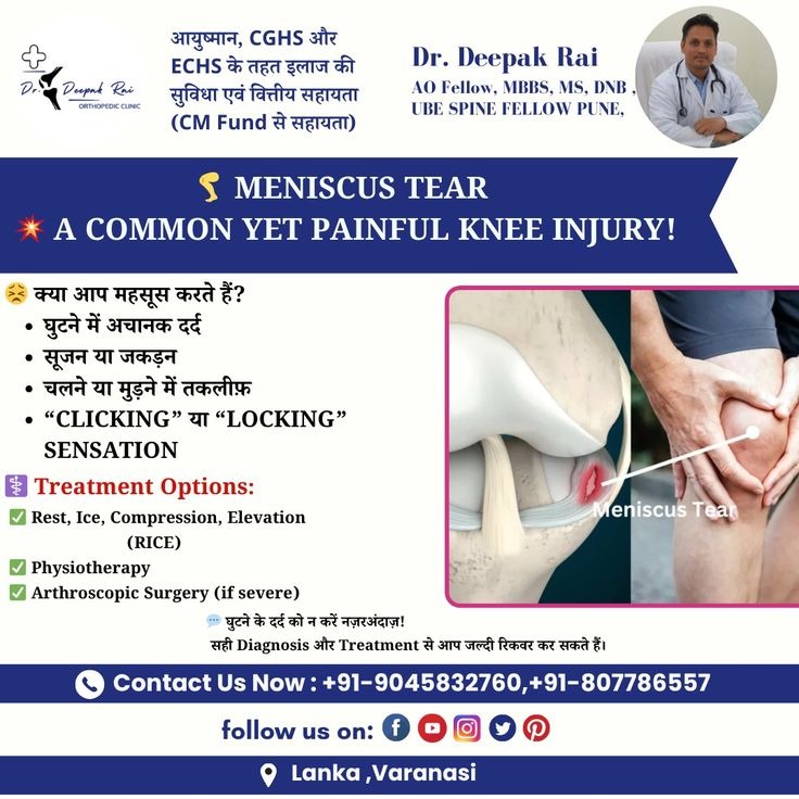 drdeepak_rai's tweet image. आयुष्मान, CGHS और ECHS के तहत इलाज की सुविधा एवं
(CM Fund से वित्तीय सहायता उपलब्ध)

📷 MENISCUS TEAR – A COMMON YET PAINFUL KNEE INJURY!

क्या आप महसूस करते हैं?
📷 घुटने में अचानक दर्द

:
#MeniscusTear #KneePainRelief #OrthopedicCare #DrDeepakRai #VaranasiDoctors #KneeInjury