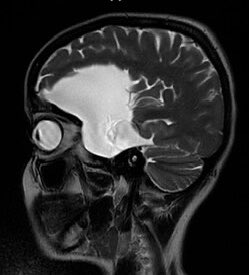 هاك فين 50K⏳ tweet media