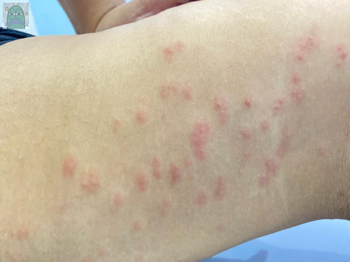 Tanyarlfes tweet media