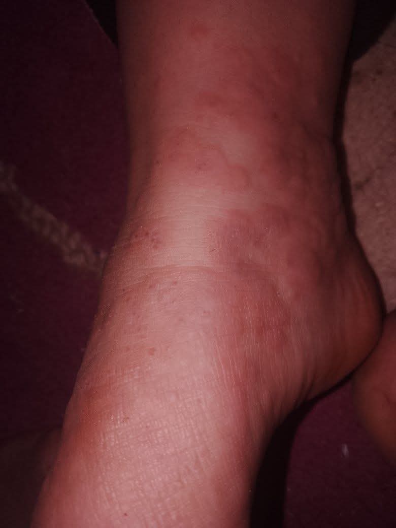 Yousef in Gaza 🇵🇸 tweet media