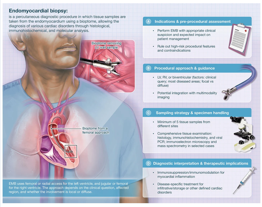 EuroInterventio's tweet image. Endomyocardial biopsy plays a pivotal role in the diagnostic workup of myocarditis, cardiomyopathies, and unexplained acute heart failure. 
Careful patient selection and expertise are essential to optimise its risk–benefit profile. #cardiotwitter #heartfailure #cardiology

👉Read