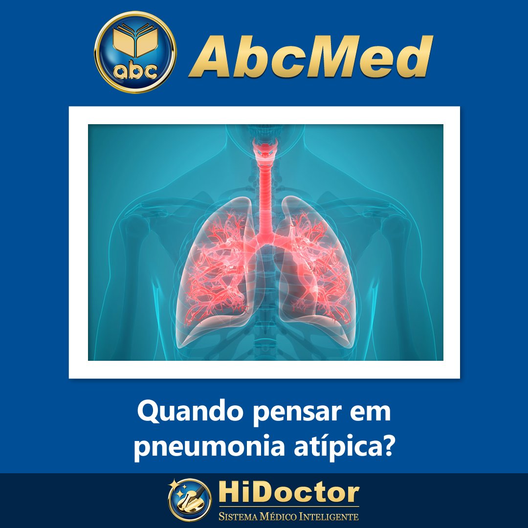 abcmedbr's tweet image. Veja o post mais lido da última semana no AbcMed

abc.med.br/sinais-sintoma…

#Pneumonia #PneumoniaAtípica #InfecçãoPulmonar