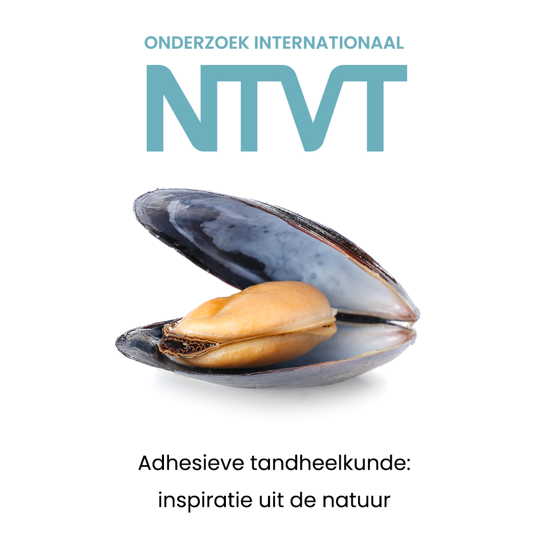 Inspiratie uit de natuur halen heeft vaak geleid tot technische doorbraken. De sterke plakkracht van mossels in moeilijke omstandigheden zou zo’n doorbraak kunnen zijn in de adhesieve tandheelkunde. 
Lees erover in de april-editie: ntvt.nl/onderzoek/onde…
#adhesievetandheelkunde