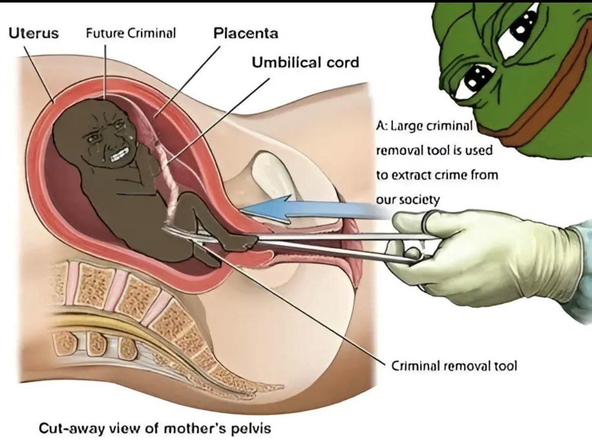 race first (stop replying or block = i win) tweet media