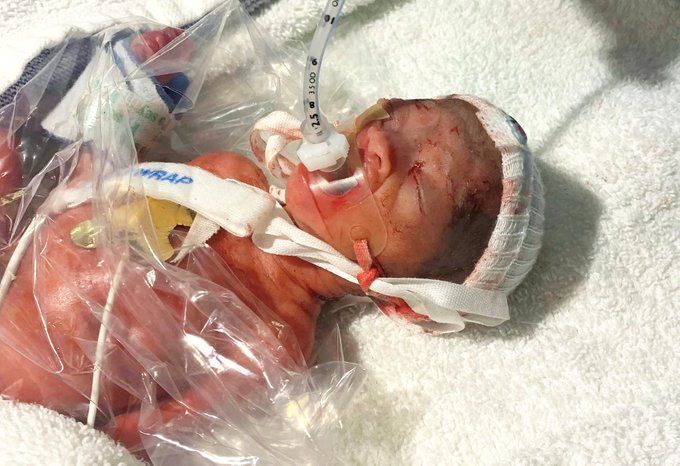 Steven Ertelt tweet media