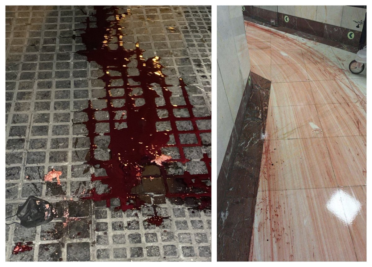 This is what this regime does to Iranians. 

<a href="/realDonaldTrump/">Donald J. Trump</a> 
<a href="/marklevinshow/">Mark R. Levin</a> 

#IranMassacre‌