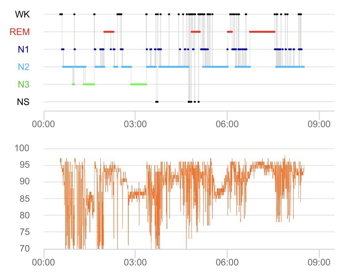 seiji__tanaka's tweet image. かなり心配なレベルの無呼吸です
すぐに専門医への受診を勧めました
※掲載許可いただいてます

#睡眠時無呼吸症候群 #SAS #OSA