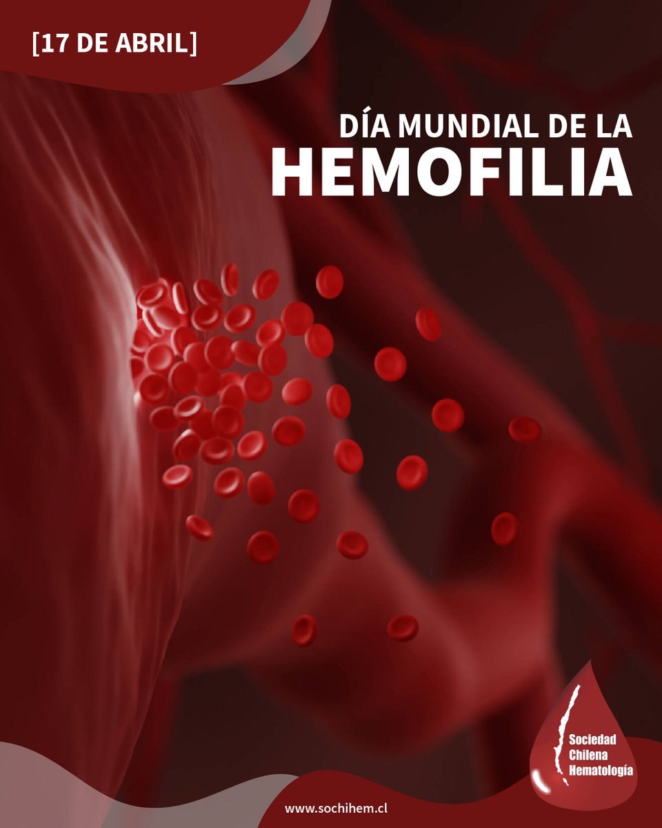 Sociedad Chilena de Hematología tweet media