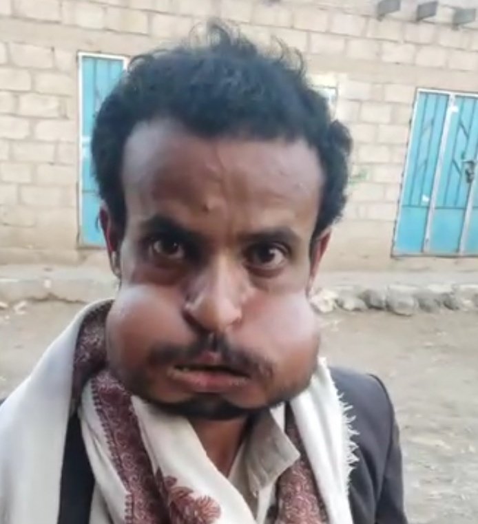 عُمر tweet media