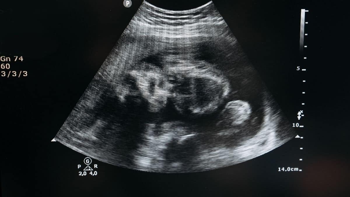 MATARMNTSR 💔🇵🇸 tweet media