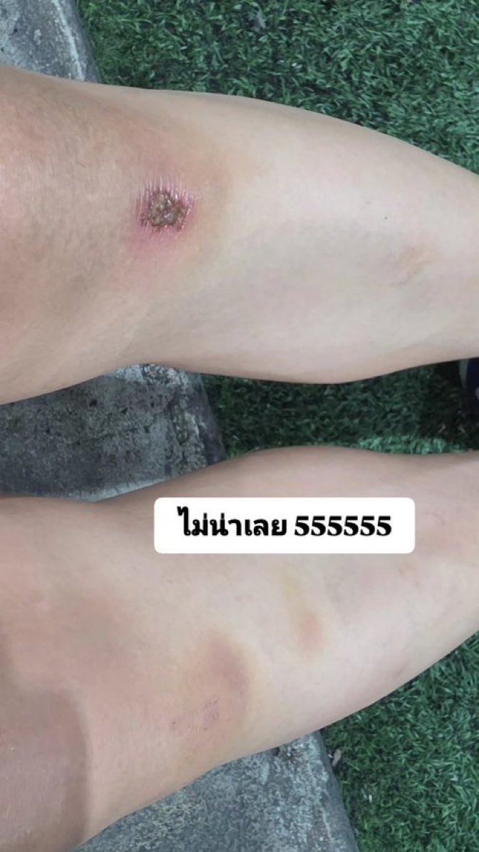 ออฟอ🍒 ᧔࿔᧓ บ้าบู๋บ๊อบโบ๊ด ‧₊˚✩彡 tweet media