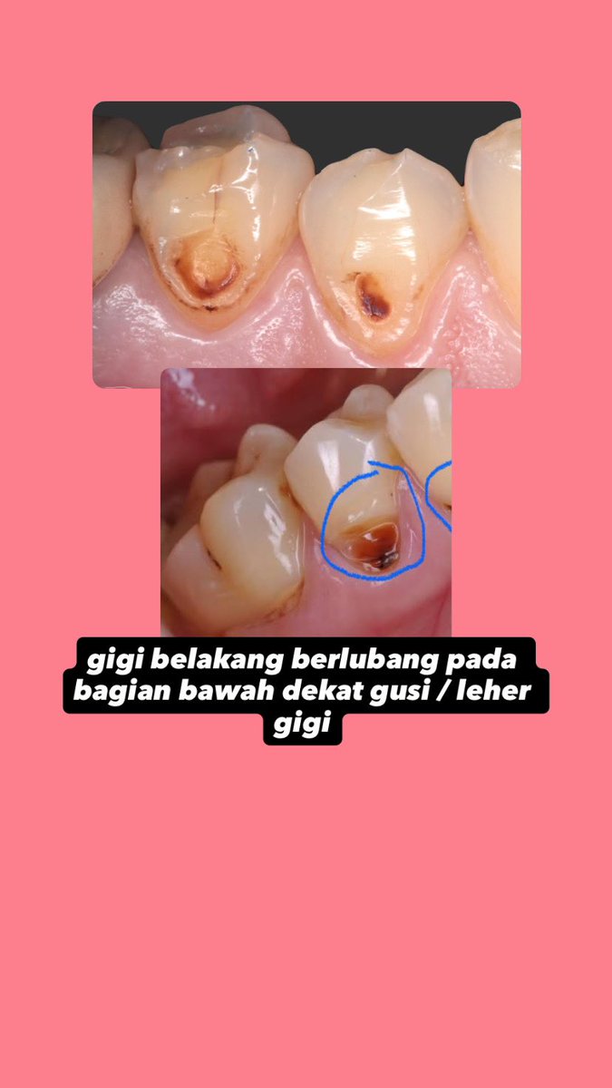 koas gigi semarang tweet media