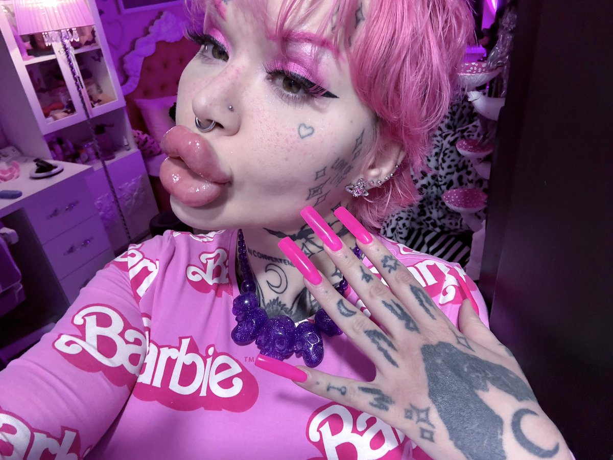 nasty_bimbo666's tweet photo. How do I look with new lips?😍 Just added 2 cc more 😮‍💨 https://t.co/mDgu4FudZS