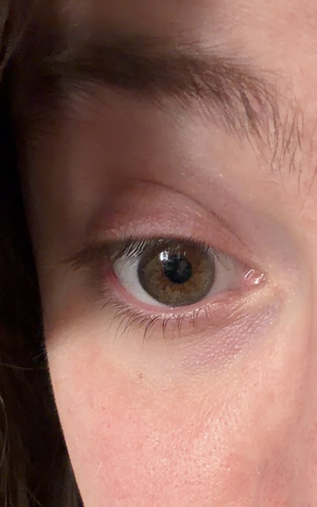 Stella Chat BPD tweet media