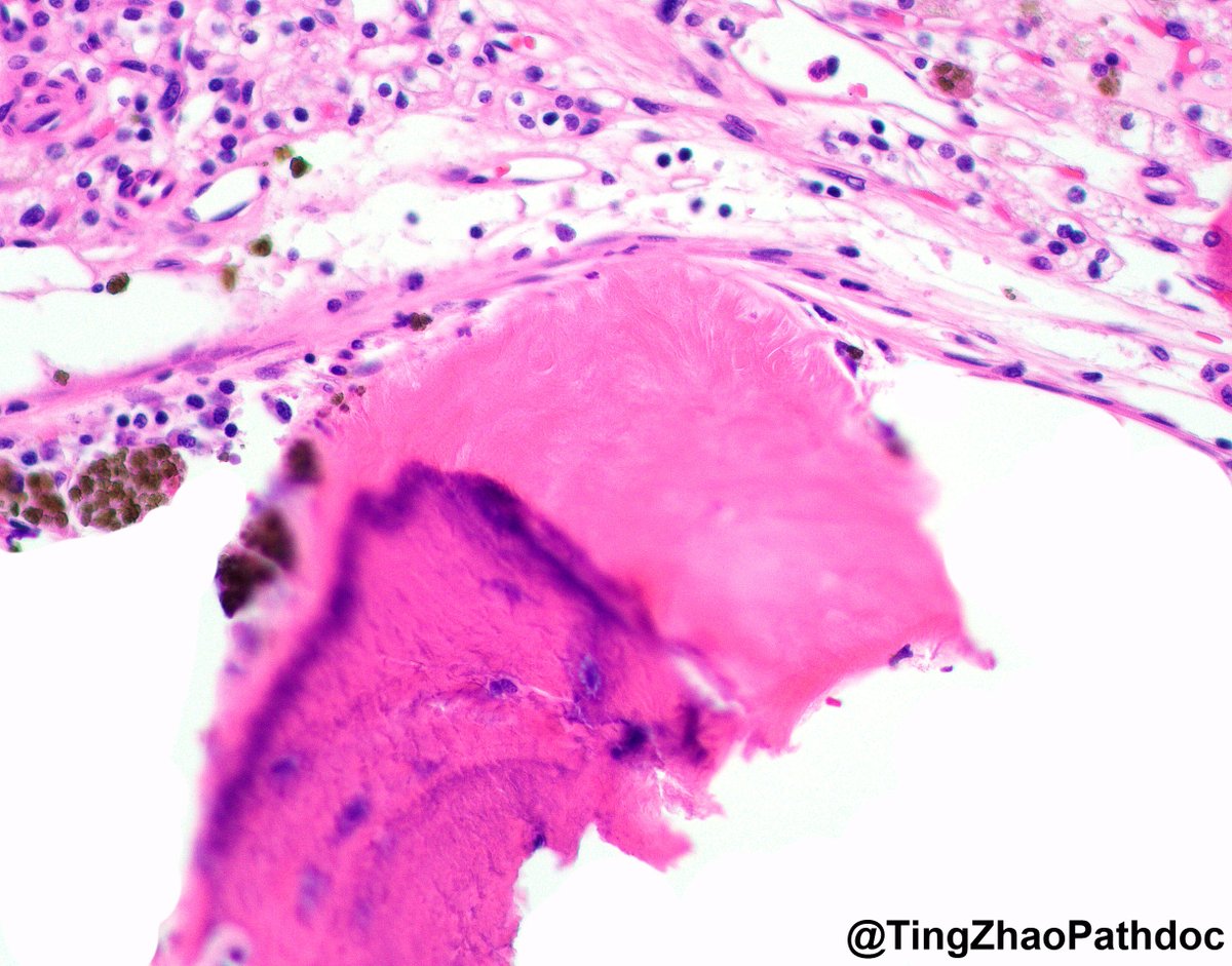 Ting Zhao, MD tweet media