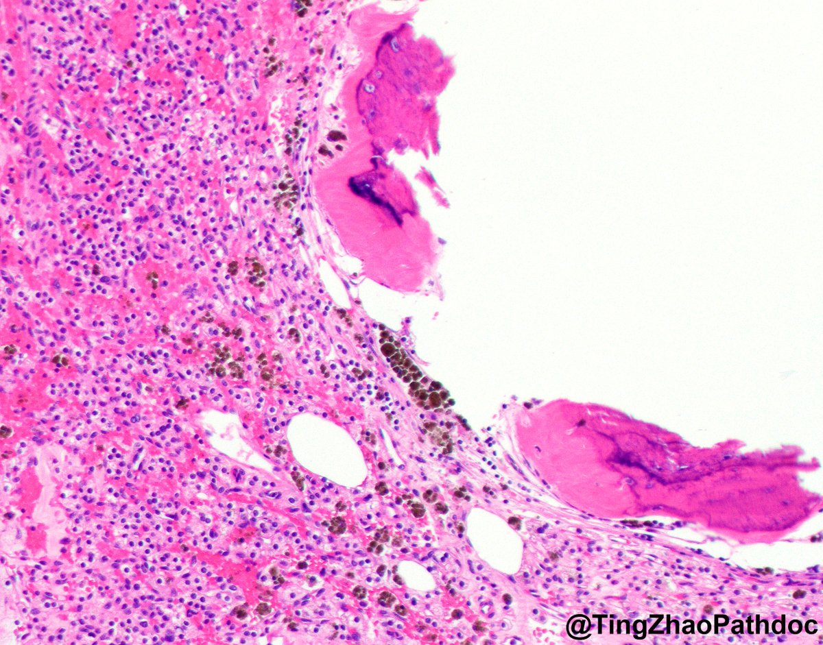 Ting Zhao, MD tweet media