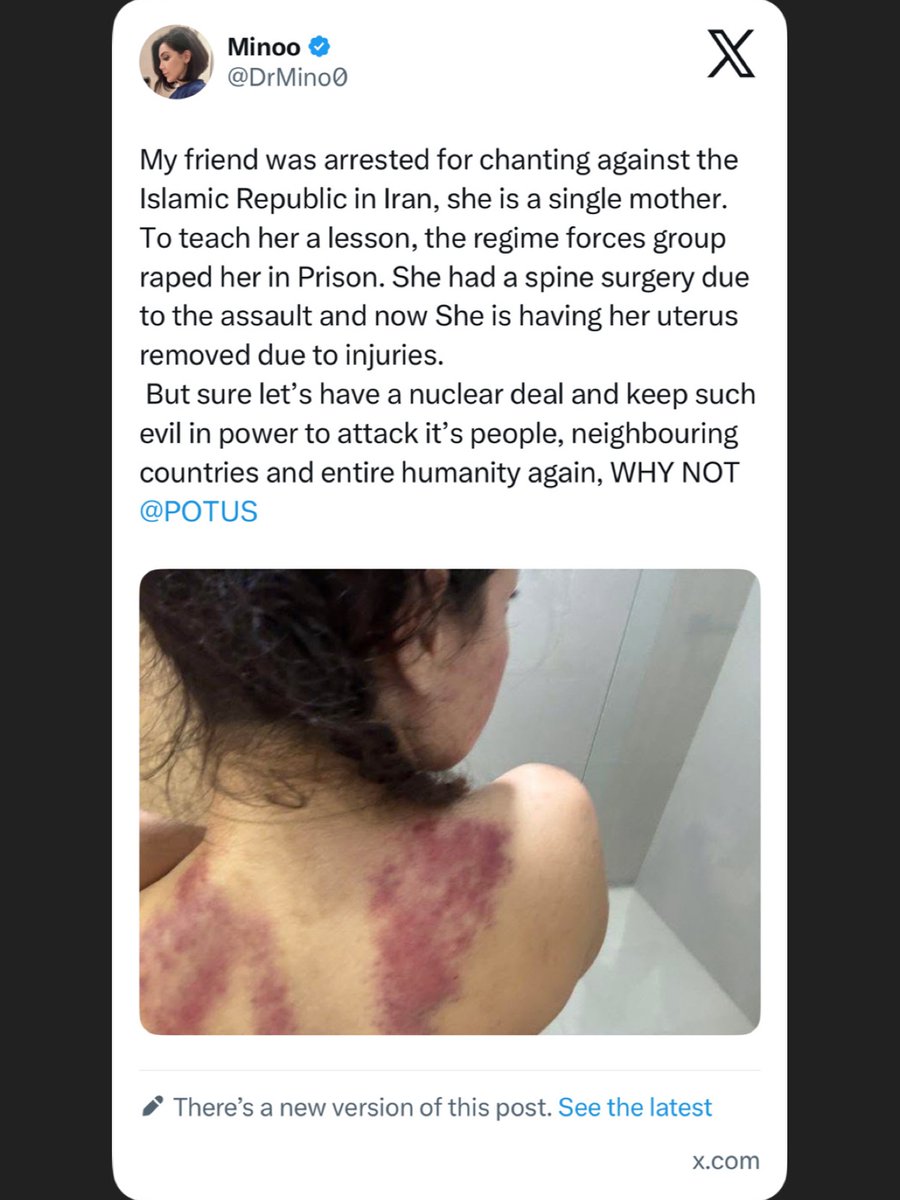 Rahmanipour1's tweet image. My friend was #arrested for chanting against the Islamic Republic in Iran, she is a single mother. To teach her a lesson, the regime forces group raped her in Prison. She had a spine #surgery due to the assault and now She is having her uterus removed due to #injuries. 
 But sure